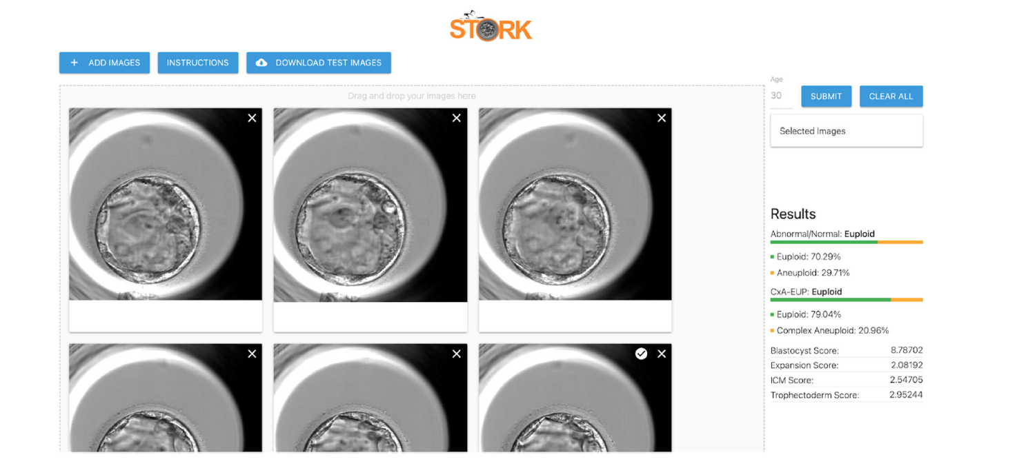 A screenshot of the STORK-V user interface showing 6 embryos. 